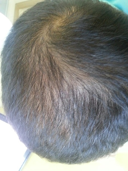 头皮纹身大满足!!!! 决定相亲了。