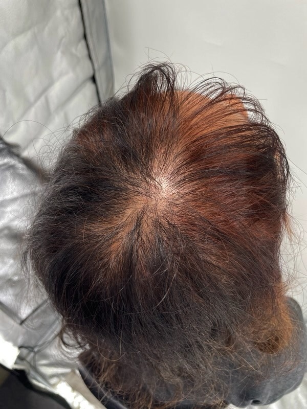 뉴헤어 헤어타투 받았습니다!