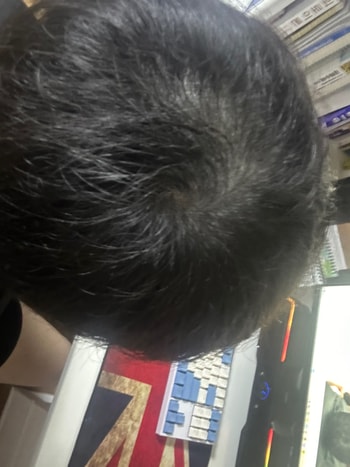 2회차 받고 3일지나고 후기입니다 !