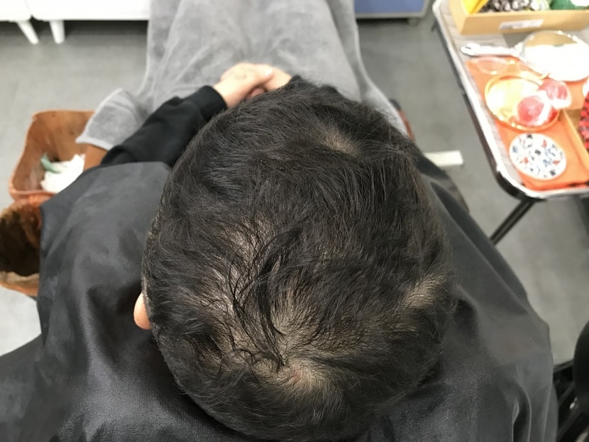 &lt;시술전 1&gt;