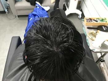 시술 후