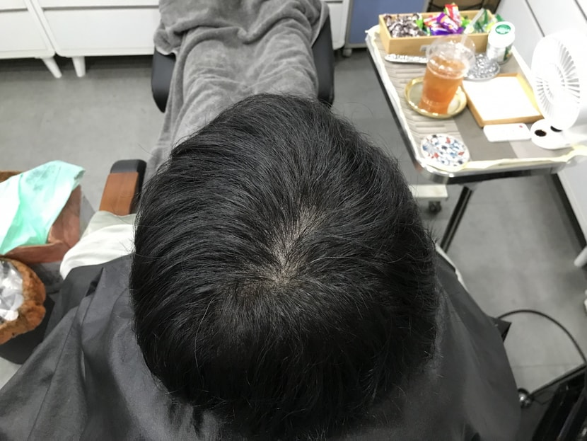 수술 후