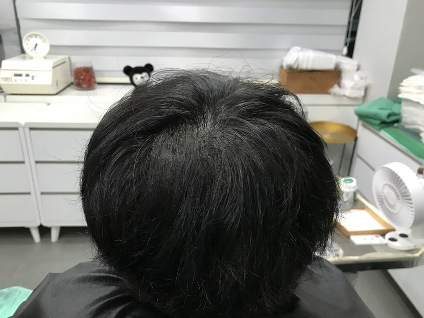 수술 후