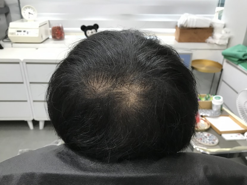 수술 전