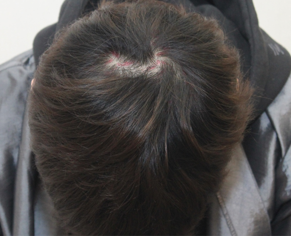 비포2.jpg