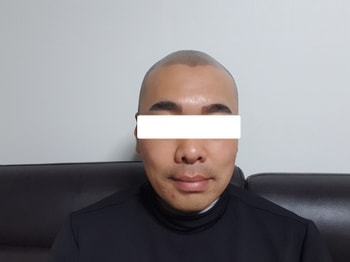 시술완료