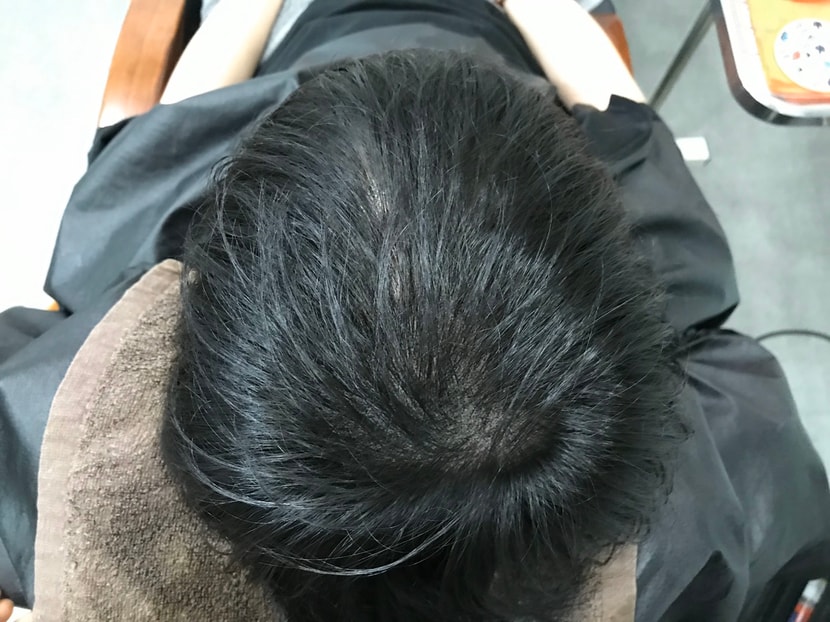1차 후