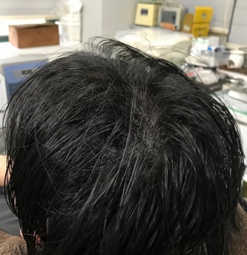 2차직후 젖은머리