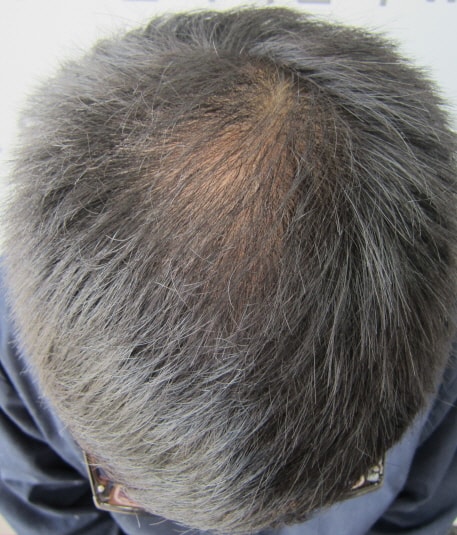 두피문신하고 만족도가 좋은듯 하네요