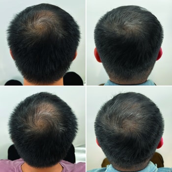 왼쪽이 비포 오른쪽이 에프터에요