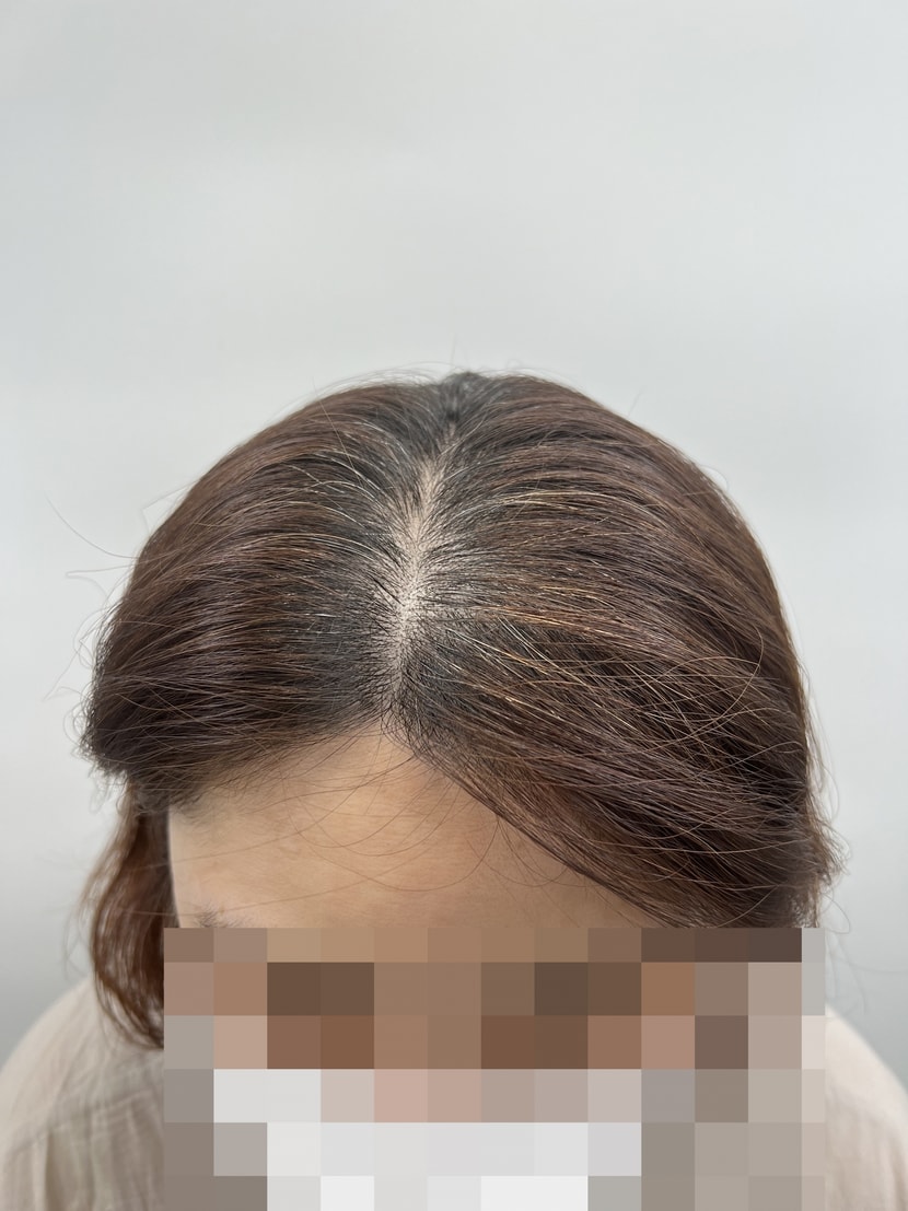 2차 에프터 