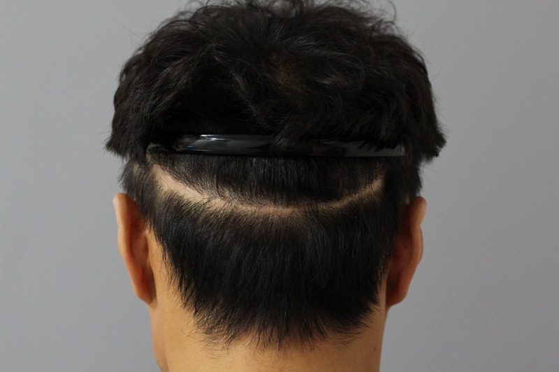 @@   This is a review of the scalp tattoo...^^  @@