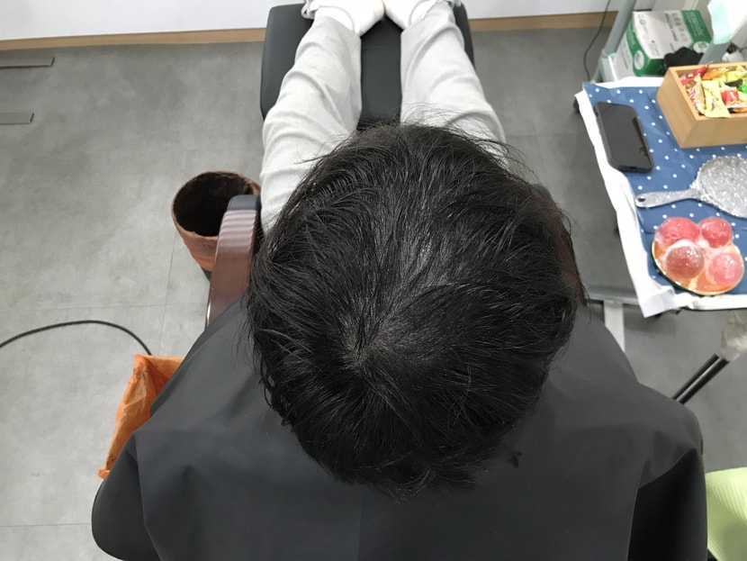 리터치 전 젖은 머리