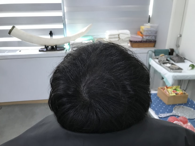 리터치 전 마른 머리