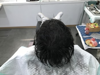 리터치 후 젖은 머리