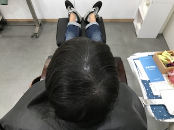 보강전 마른머리