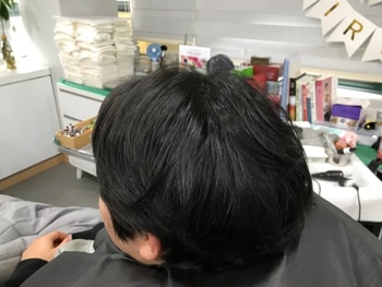 시술 후