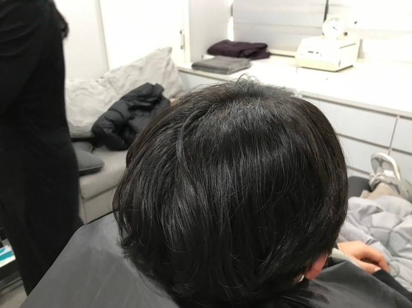 시술 후