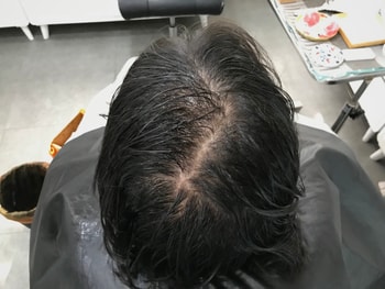시술 전 젖은 머리