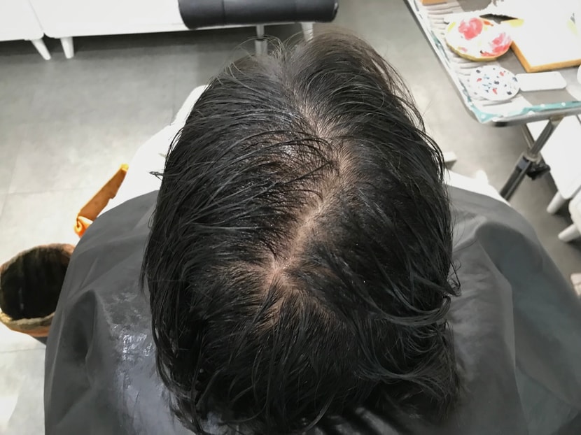 시술 전 젖은 머리