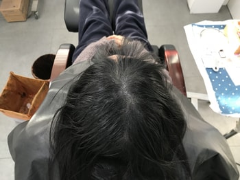 물묻힌 후의 두피에요 제가 두피가 조금 안좋아서 걱정했는데 다행이 잘 관리되었다고 합니다