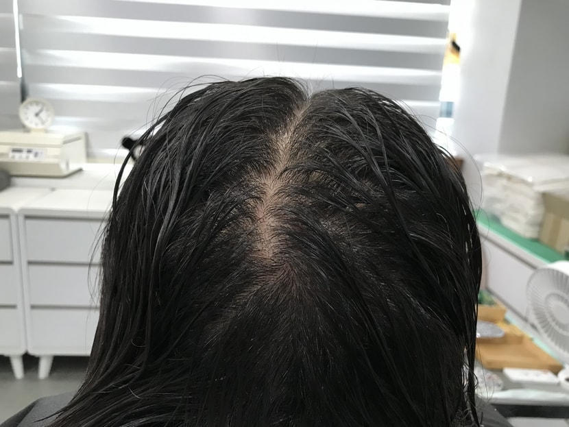 문신 전