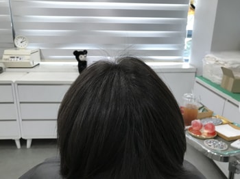 리터치 후