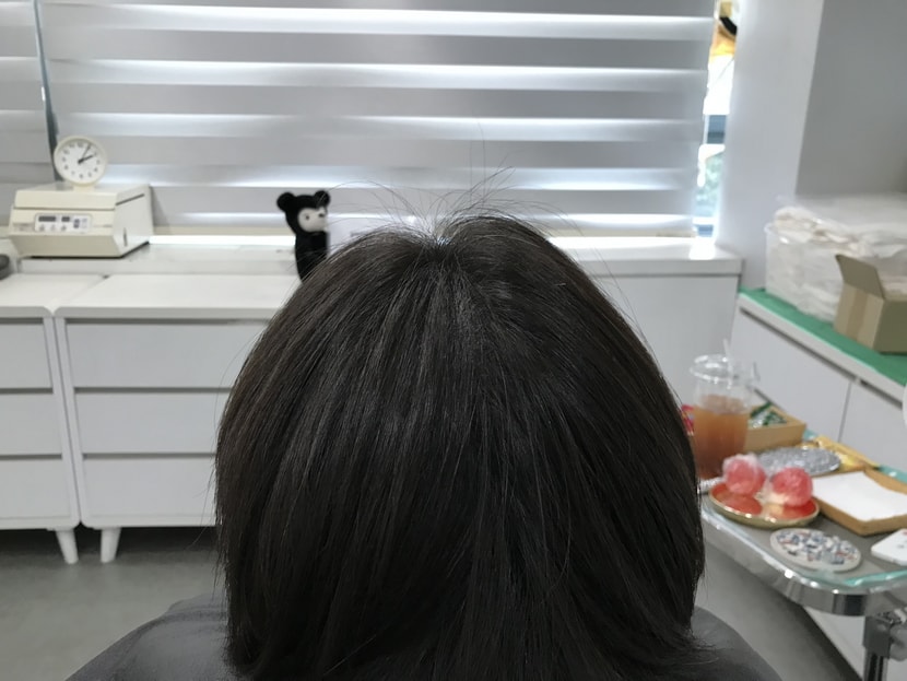 리터치 후