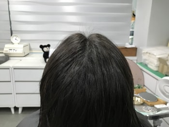 문신 후 