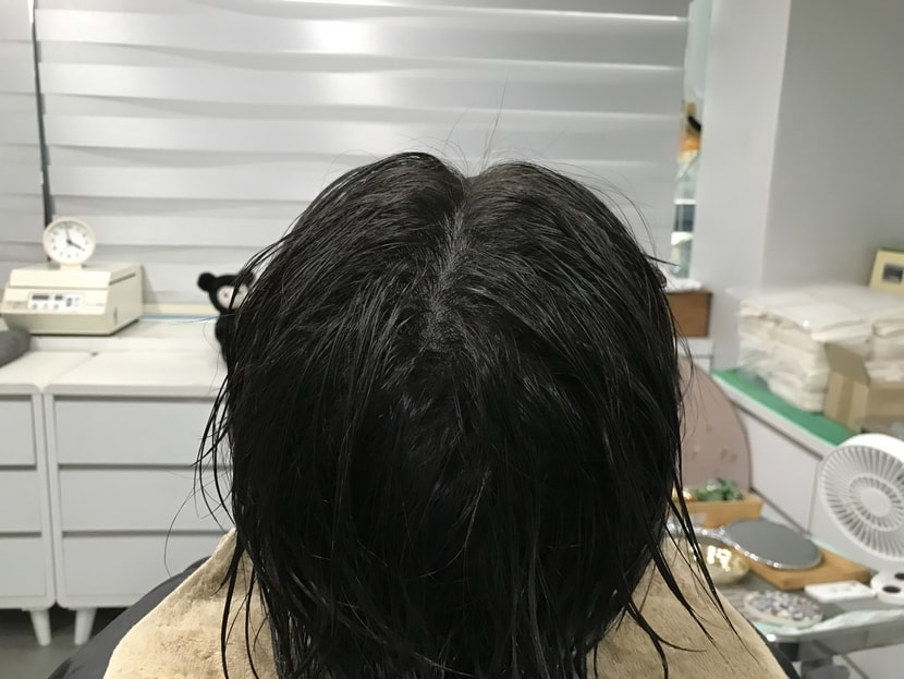 문신 후 