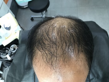 문신 전