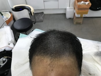 문신 후