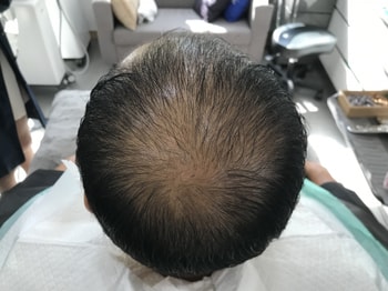 문신 전