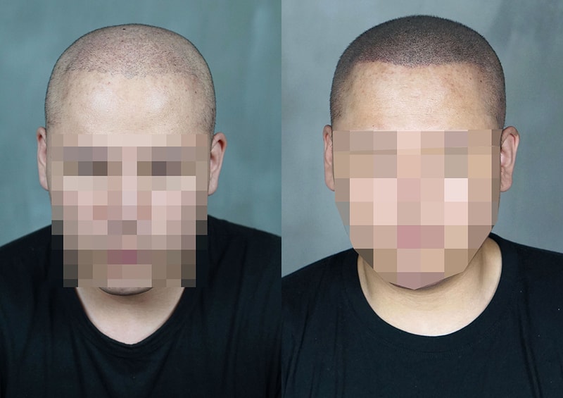 我是做头皮纹身的纹身师