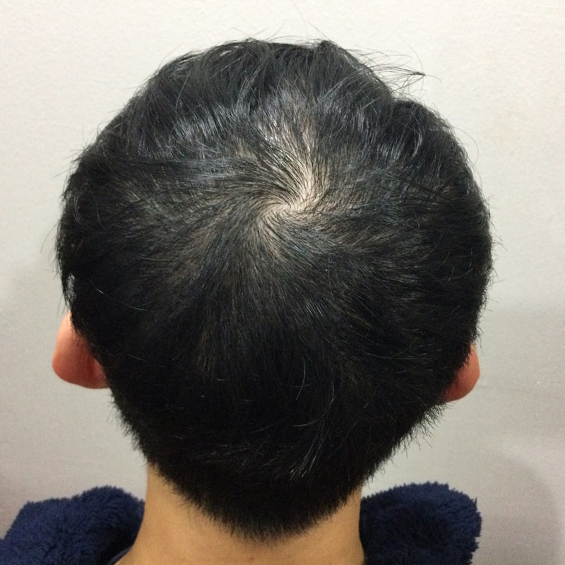 2次体験談です。