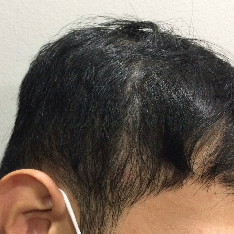 1次体験談です。