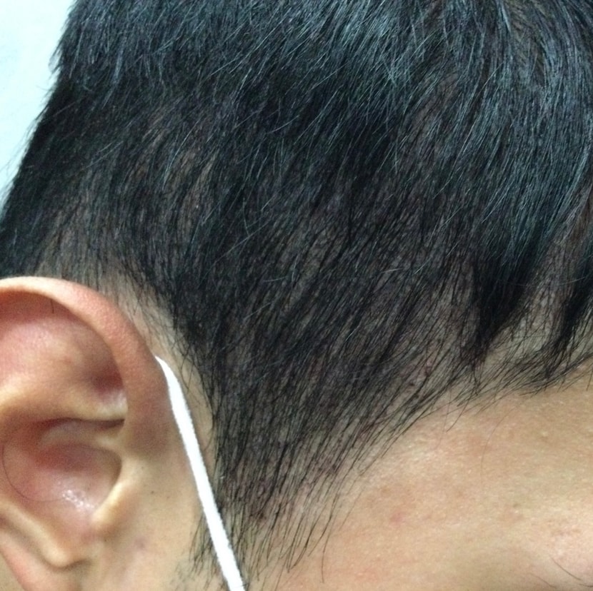 후