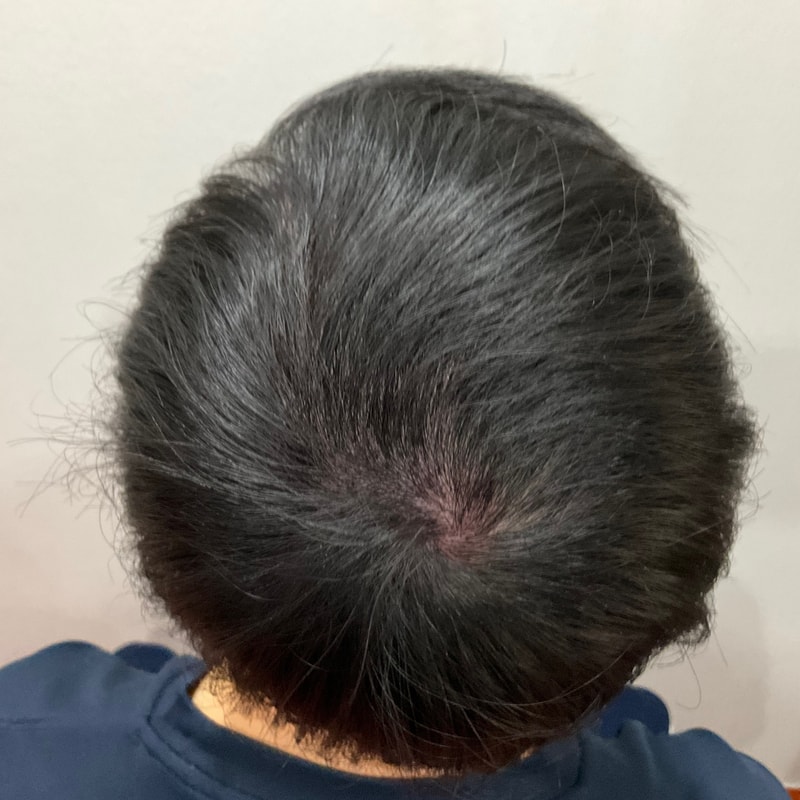 3次体験談です。