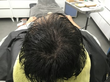 시술후 젖은머리
