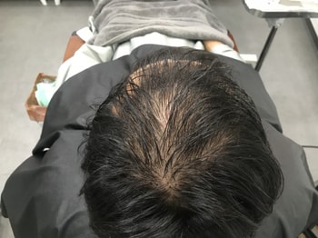시술전 젖은머리