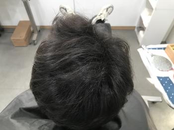 리터치 전