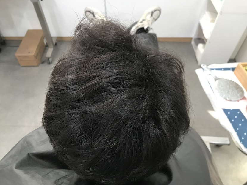 리터치 전