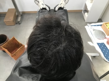 리터치 전 