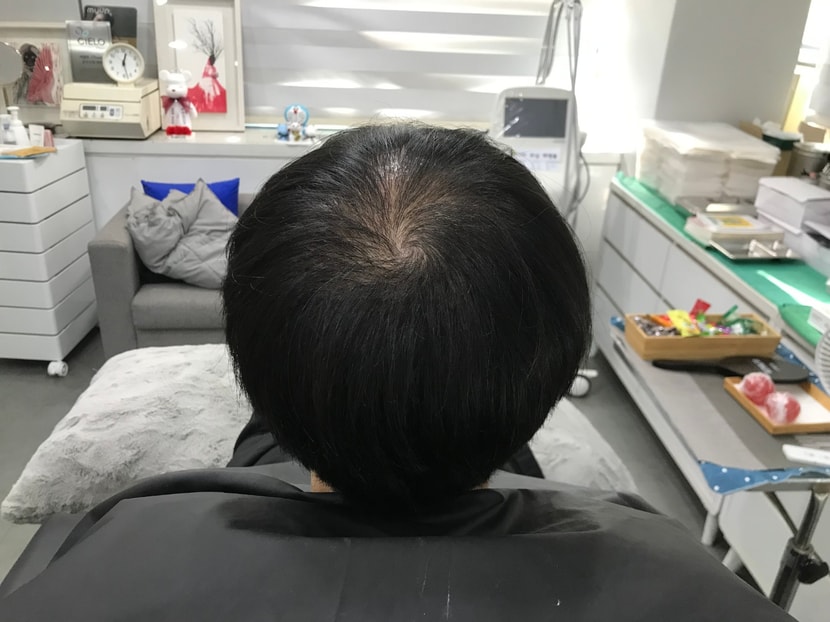 시술 전 마른 머리 사진 1 