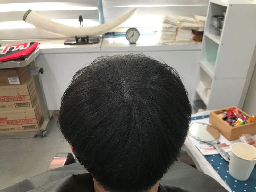 리터치 후 마른 머리 사진 1