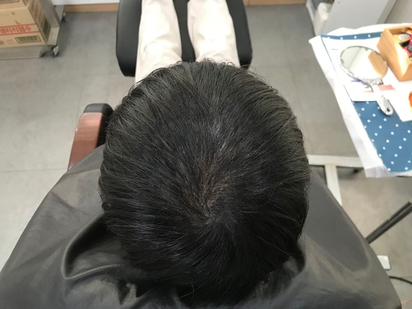 리터치 전 마른 머리 2