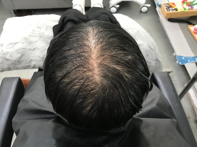시술 전 젖은 머리 사진 2 