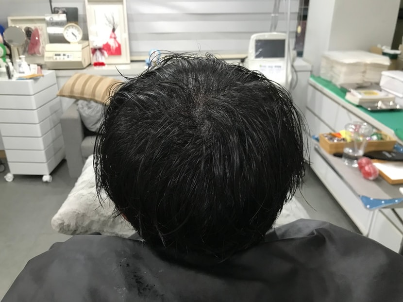 시술 후 젖은 머리 사진 1