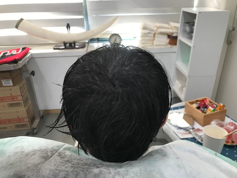 리터치 후 젖은 머리 사진 1