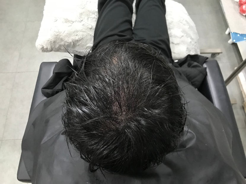 시술 후 젖은 머리 사진 2